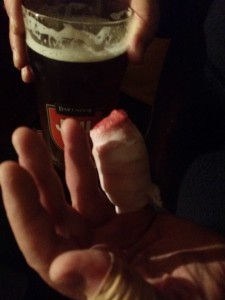 Bloody finger injured whilst Hashing