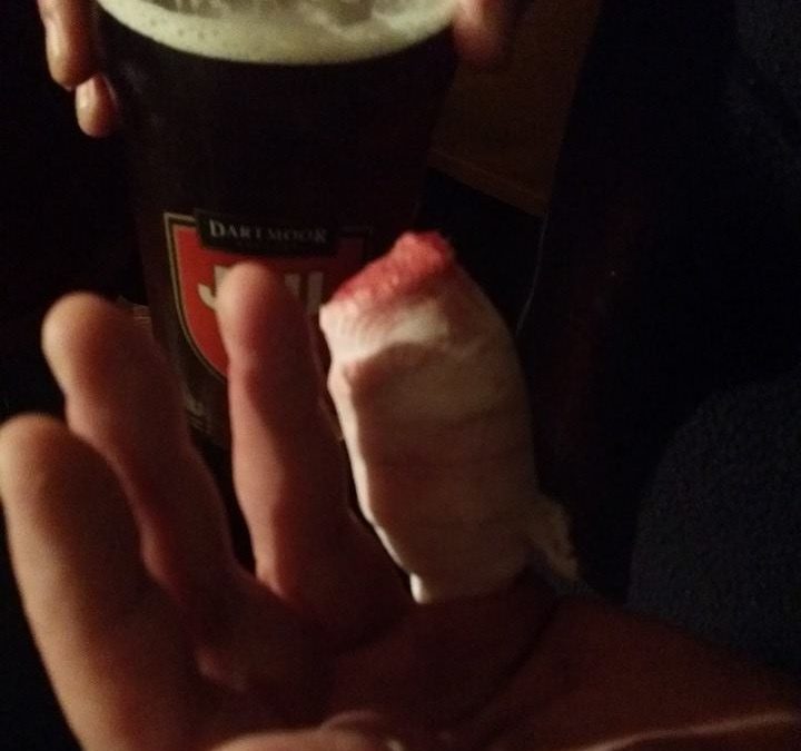 injury-topshelf-wirefence